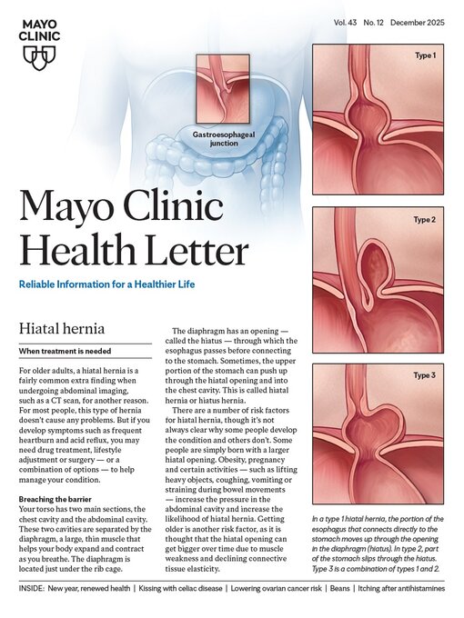 Title details for December 2025. Mayo Clinic Health Letter by Mayo Clinic - Available